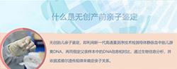 赤峰怀孕了需要怎么做亲子鉴定,赤峰产前做亲子鉴定办理流程 赤峰怀孕了需要怎么做亲子鉴定,赤峰产前做亲子鉴定办理流程