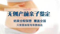 海口怀孕了如何做亲子鉴定，海口产前办理亲子鉴定办理条件